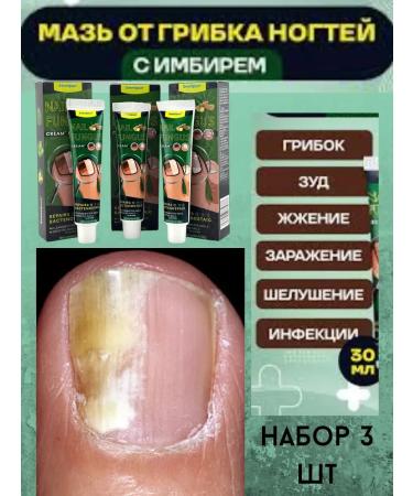 Leila ointment from the fungus