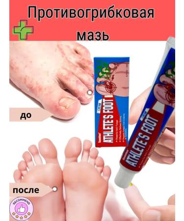AlexaMM Ointment from the fungus of the nails and skin of the legs