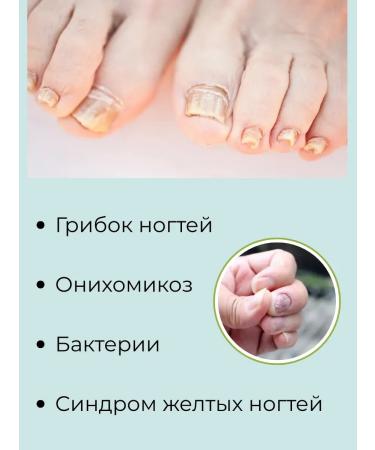 NK1314 Cream from nail fungus and cracks Effective 3 pcs - Buy Online on GoSupps.com