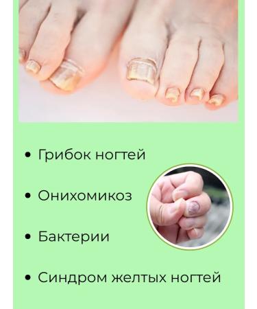 NK1314 Cream from nail fungus and cracks for the legs and arms - Buy Online on GoSupps.com