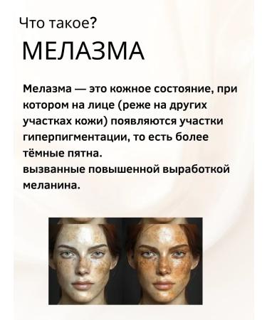 mua Cream from age spots on the face of a healing - Buy Online on GoSupps.com