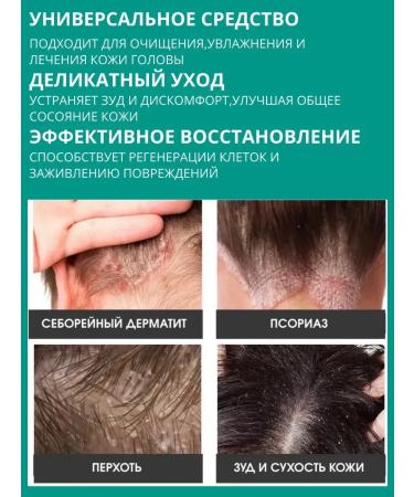 Mikos Cream from seborrheic dermatitis - Buy Online on GoSupps.com