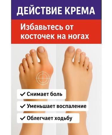 Bilioner W Cream from bones and cones on the thumb of the leg 3pcs - Buy Online on GoSupps.com