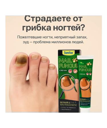 MAC1 Antifungal cream for nails and skin