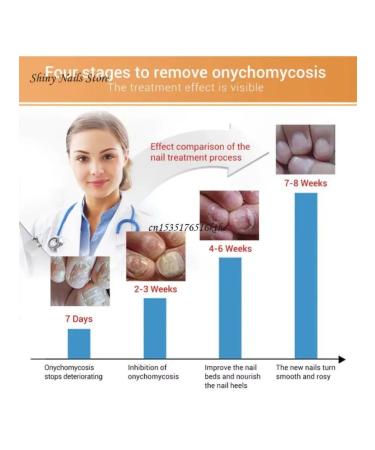 adellemix Remedy for nail fungus and yellowness saw - Buy Online on GoSupps.com