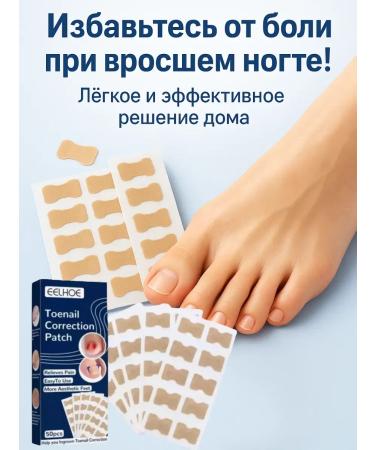 COME Plasters from an ingrown nail