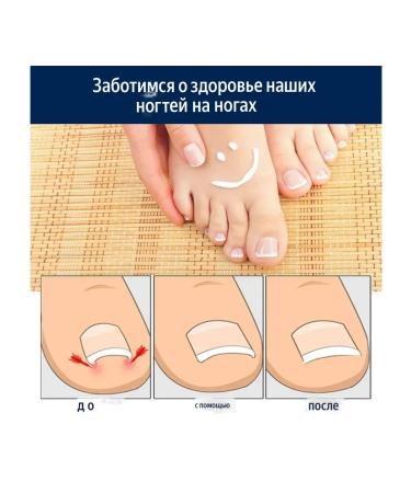 datka7 Stifflays from ingrown nails and nail fungus 50pcs - Buy Online on GoSupps.com