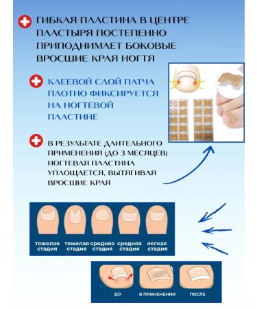 Kubataeva Patch from nail fungus on the legs and an ingrown nail - Buy Online on GoSupps.com