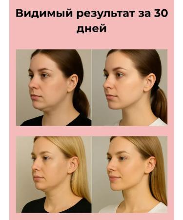 Ant 1 Lifting mask Bandage for a chin pulling set - Buy Online on GoSupps.com