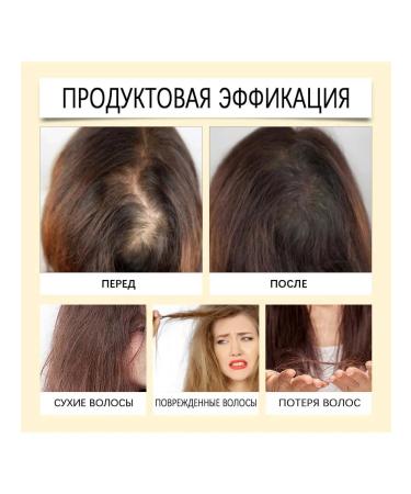 Hoegoa hair oil nourishes strengthens against dry falling out - Buy Online on GoSupps.com