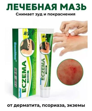 Chinese Simufin creams Eczema and dermatitis cream