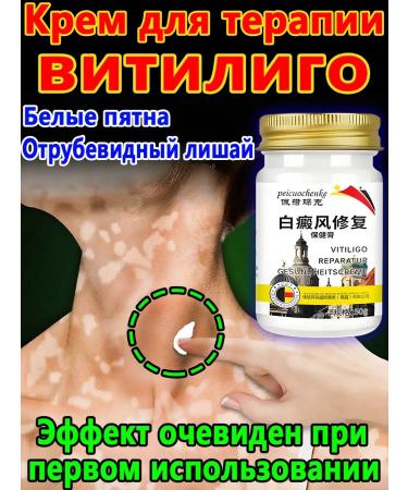 Vitiligo cream treatment efficiently removes white spots - Buy Online on GoSupps.com