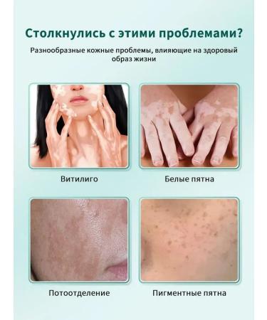 Vitiligo cream treatment efficiently removes white spots - Buy Online on GoSupps.com