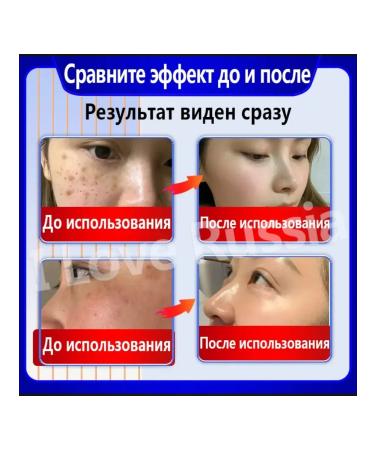 Cream for whitening and removing pigmentation - Buy Online on GoSupps.com