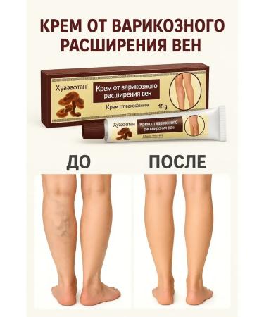 OKEN ointment from varicose veins on the legs of China anti -inflammatory cream