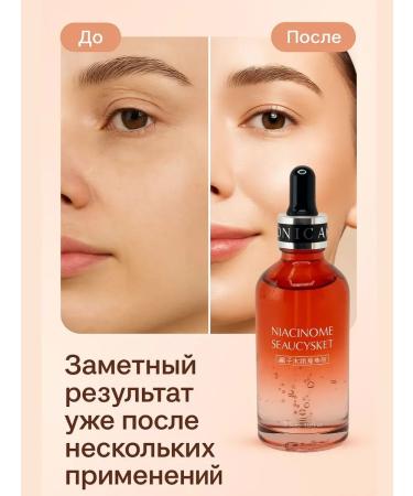 zozo Facial serum brightening with niacinamide - Buy Online on GoSupps.com