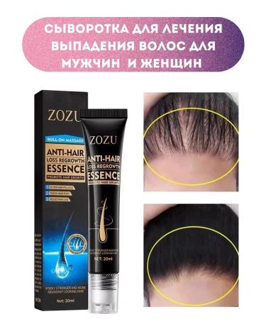 Serums Serum for the treatment of hair loss for men and women