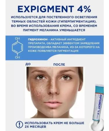 Bilioner Face whitening cream Expigation 4% - Buy Online on GoSupps.com