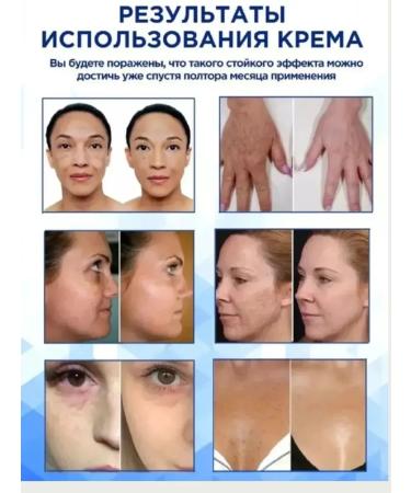 Bilioner Face whitening cream Expigation 4% - Buy Online on GoSupps.com