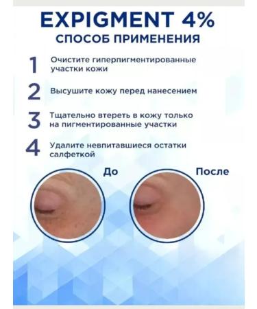 Bilioner Face whitening cream Expigation 4% - Buy Online on GoSupps.com