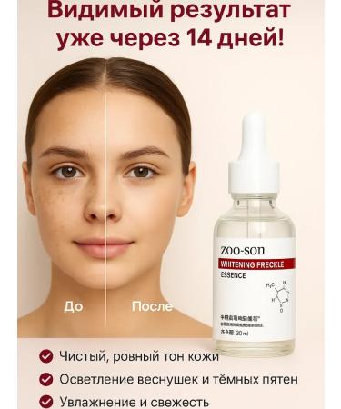 M TRADE Whitening serum from freckles and face pigmentation - Buy Online on GoSupps.com