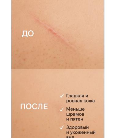 BIBA90 Cream for scars and scars - Buy Online on GoSupps.com