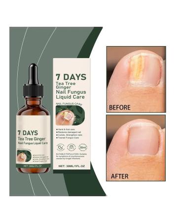 3pcs of nails for nails moisturizing and strengthening - Buy Online on GoSupps.com