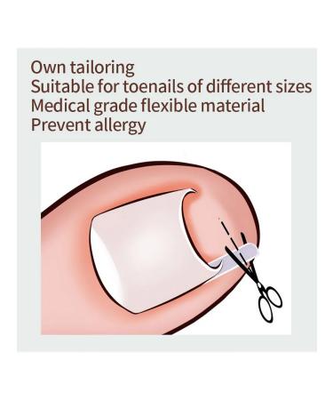 Corner corrector C-shaped health for feet (02) - Buy Online on GoSupps.com