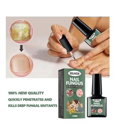 Fly for the treatment of nail fungus 15ml nail recovery - Buy Online on GoSupps.com