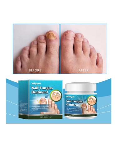 Nail cream 20g for recovery and repair damaged - Buy Online on GoSupps.com