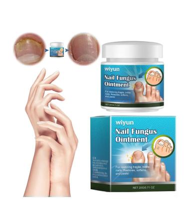 Nail cream 20g for recovery and repair damaged - Buy Online on GoSupps.com