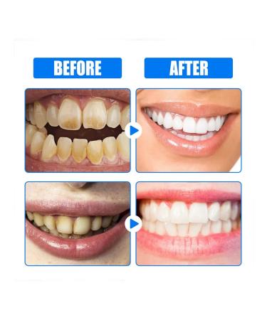 Toothpaste for bleaching 60g tooth cleaning (watermelon) - Buy Online on GoSupps.com