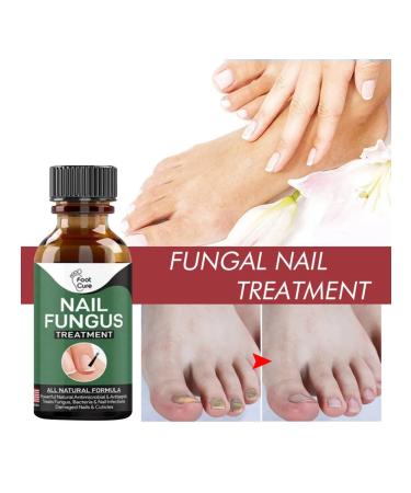 10 50 ml cream from nail fungus without Ozivvf pain (50ml) - Buy Online on GoSupps.com