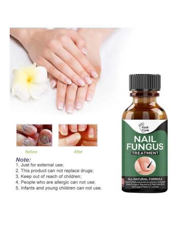 10 50 ml cream from nail fungus without Ozivvf pain (50ml) - Buy Online on GoSupps.com