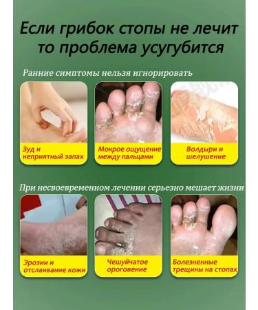 Feeling remedy on the legs and smell 50g - Buy Online on GoSupps.com