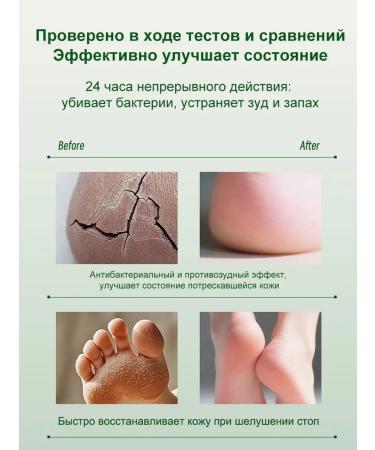 Ointment from nail fungus - Buy Online on GoSupps.com