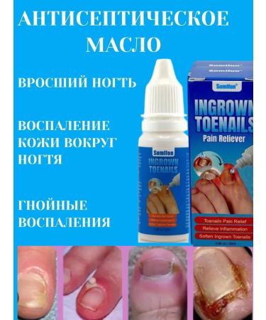 KKM Paronichia oil and ingrown nails pain relief - Buy Online on GoSupps.com