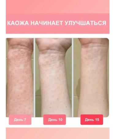 IMC Chinese miracle ointment from psoriasis from acne and dermatitis - Buy Online on GoSupps.com