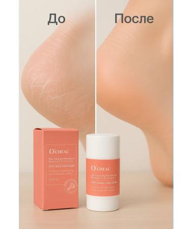 shaFixx1 Cream for heels from cracks and dryness in the stick - Buy Online on GoSupps.com