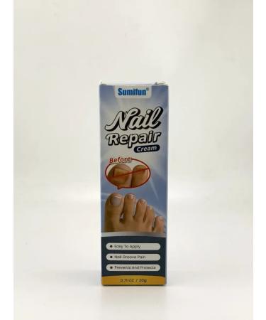 Baxtli Nail fungus cream and to restore the nail plate - Buy Online on GoSupps.com