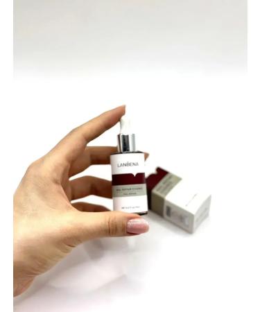 Baxtli Nail whey and chigules are therapeutic against the fungus - Buy Online on GoSupps.com