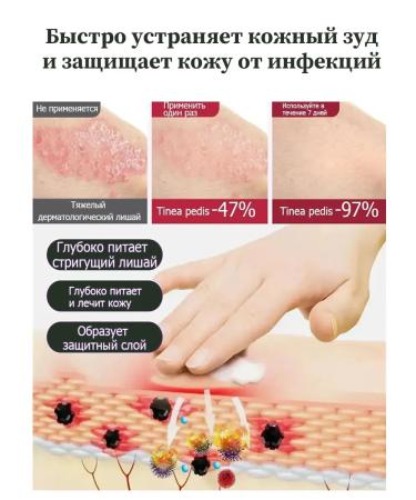 Itching cream is relieved of bacterial infections 20 g - Buy Online on GoSupps.com