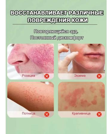 Itching cream is relieved of bacterial infections 20 g - Buy Online on GoSupps.com