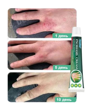 Itching cream is relieved of bacterial infections 20 g - Buy Online on GoSupps.com