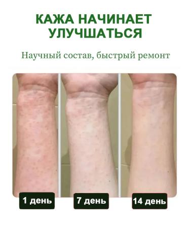 Itching cream is relieved of bacterial infections 20 g - Buy Online on GoSupps.com