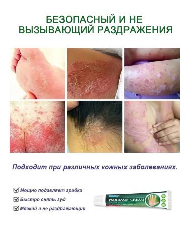 Itching cream is relieved of bacterial infections 20 g - Buy Online on GoSupps.com