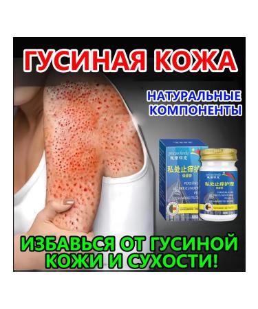 Cream for the treatment of goose skin on the hands 50 g