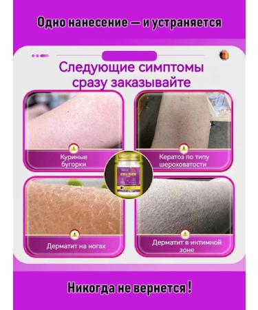 Cream from goose skin on the legs 50 g - Buy Online on GoSupps.com