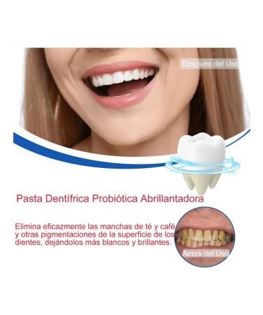 Probiotic pasta for teeth whitening SP-6 3 pcs - Buy Online on GoSupps.com