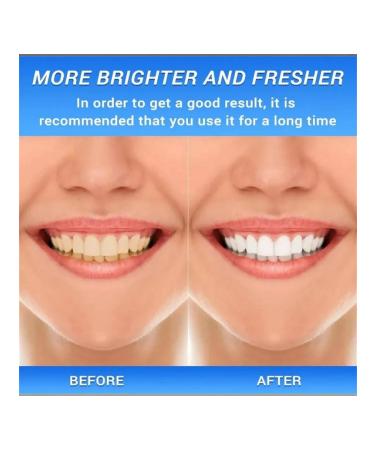 Toothpaste eR toothpaste whitening - Buy Online on GoSupps.com